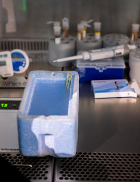 Slider image (8) Best Fertility Clinic - SAKALLI IVF